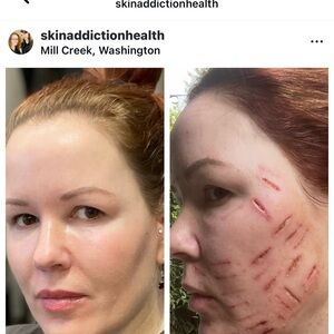 Professional Scar Treatment & Skin Recovery Solution